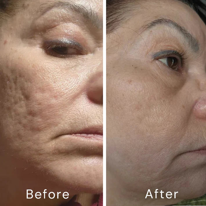 Bexelora A313™ Retinol Skin Cream