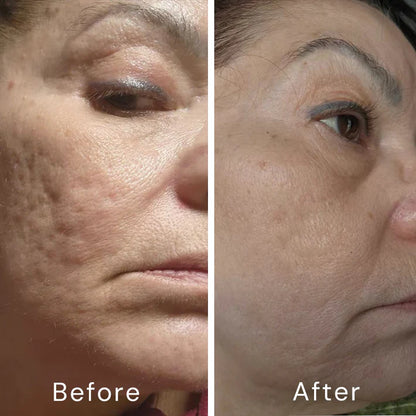 Bexelora A313™ Retinol Skin Cream