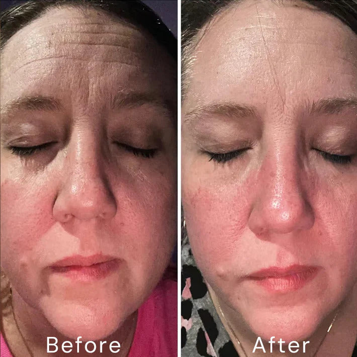 Bexelora A313™ Retinol Skin Cream