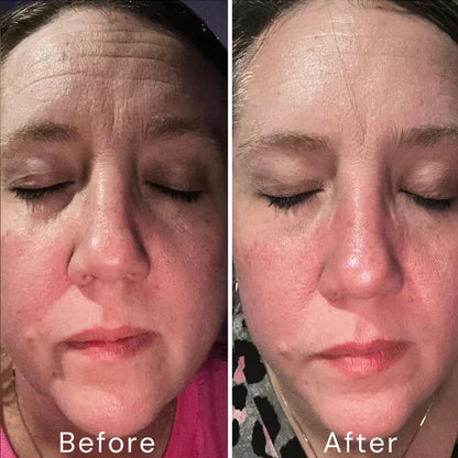 Bexelora A313™ Retinol Skin Cream