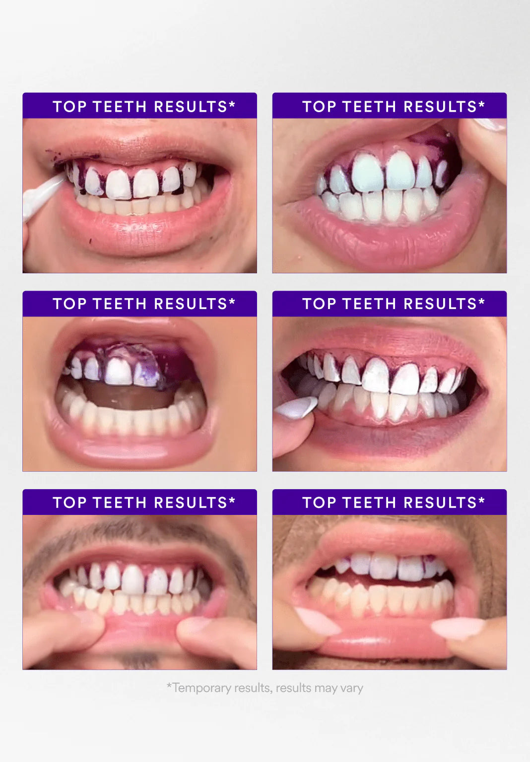 V34 Whitening Strips